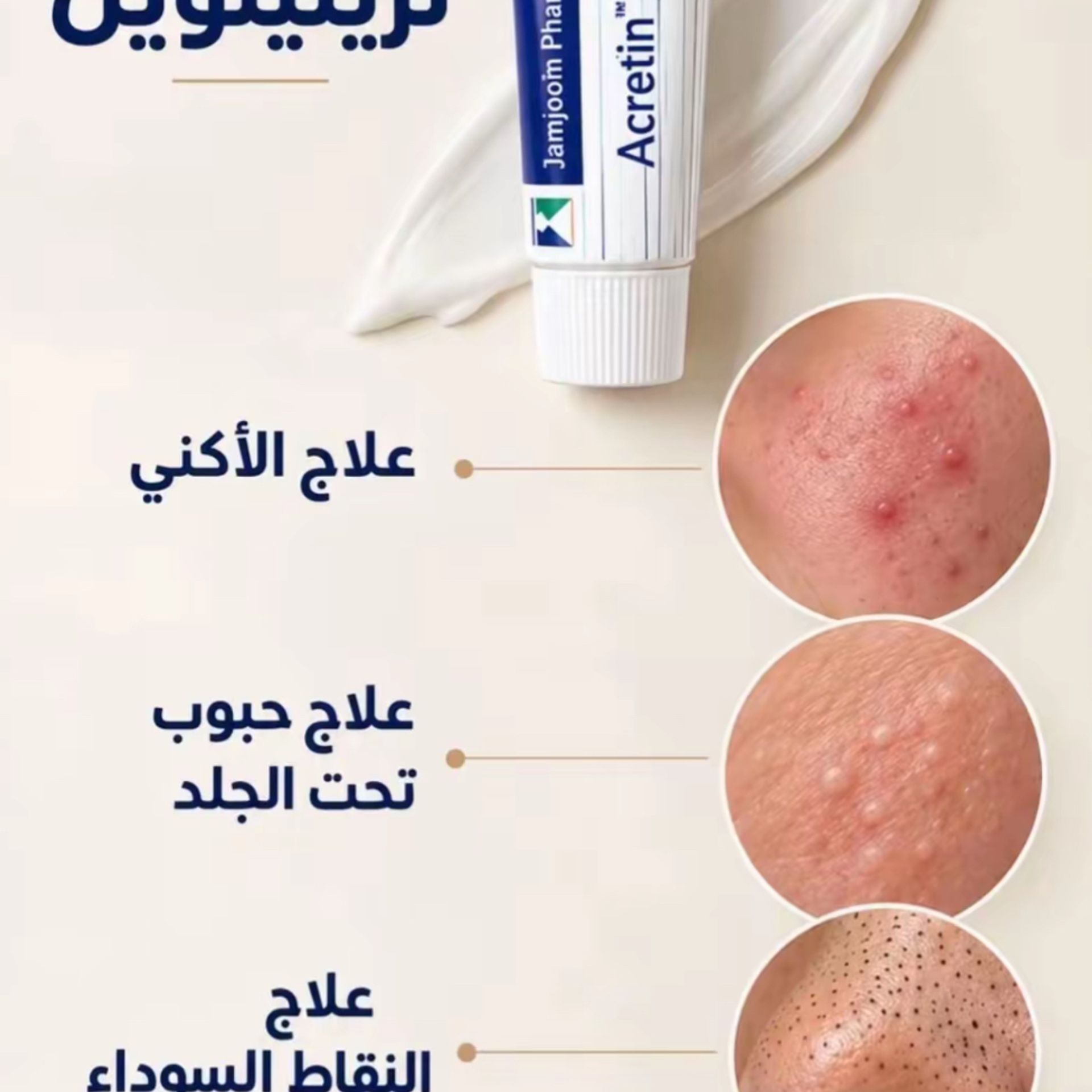Tu as enfin trouvé le produit miracle contre l'acné et les taches