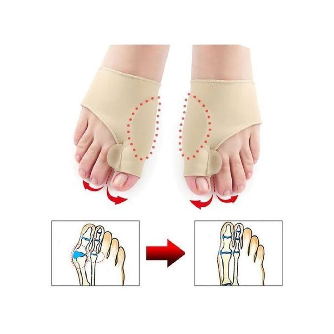Correcteur Du Gros Orteil Soins Des Pieds, Soulagement De La Douleur - Image 1 of 4