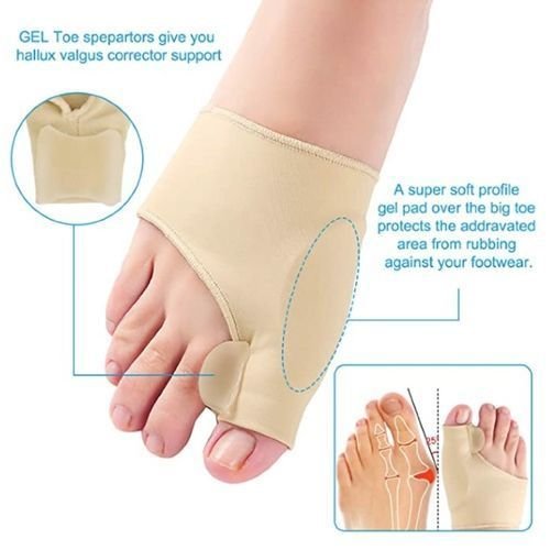 Correcteur D'oignon Et Attelle Orthopédique, Protecteur D'orteils En Gel, 1paire - Image 1 of 4