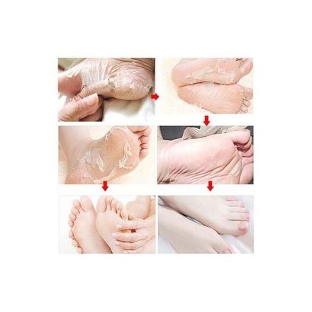 Exfoliating Socks, Chaussettes Exfoliante, Soin Anti Callosité thumbnail 3