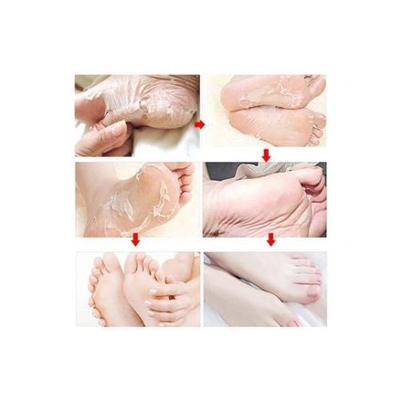 Exfoliating Socks, Chaussettes Exfoliante, Soin Anti Callosité thumbnail 3