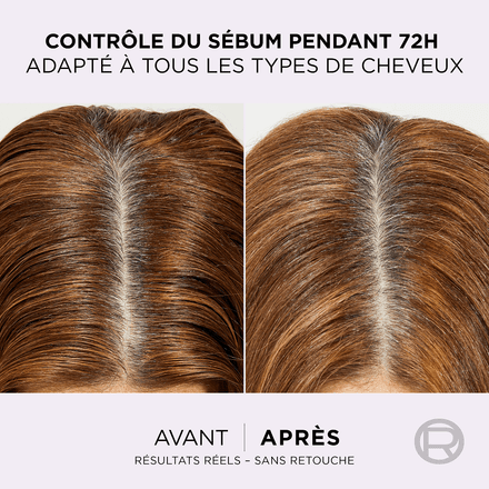 Coffret Elseve Hyaluron Pure – Sérum Hydratant 102ml + Trousse Vanity Offerte thumbnail 4