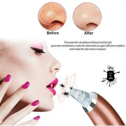 Aspirateur Points Noir Instrument De Nettoyage Du Visage Appareil - Multi-couleur thumbnail 2