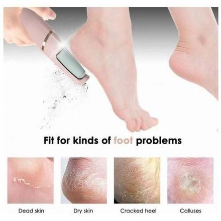 Outil De Pédicure Électrique Pour Soins Des Pieds, Élimine Les Callosités thumbnail 3