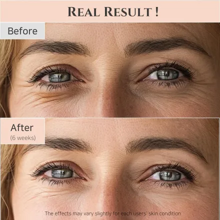Beauty Of Joseon Revive Eye Serum Ginseng + Retinal - 30 Ml thumbnail 3