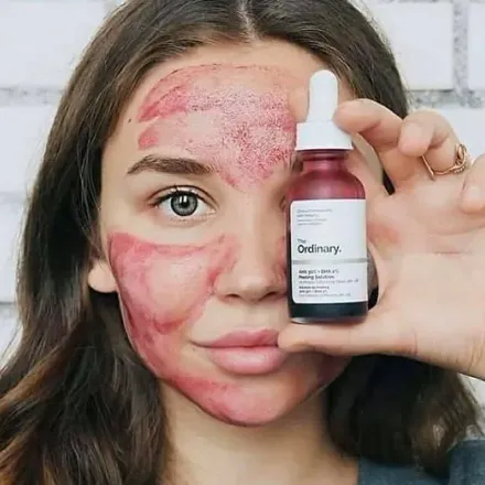 Peeling Solution Aha 30% + Bha 2% thumbnail 2