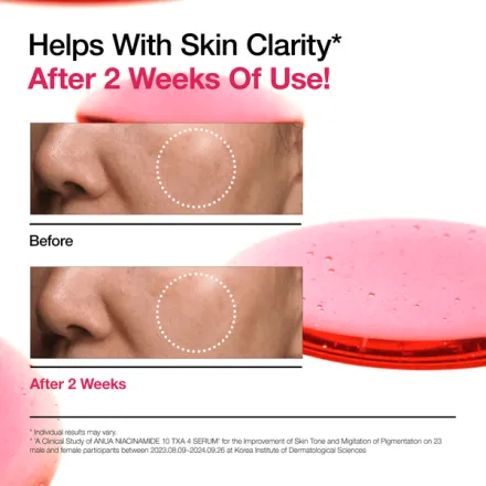 Niacinamide 10 Txa 4 Serum For Brightening And Dark Spots thumbnail 4