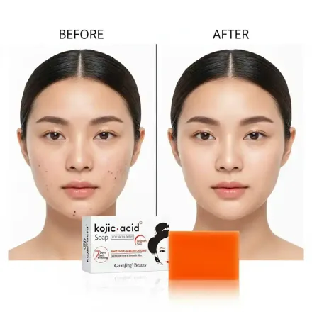 Kojic Acid Soap For Face & Body – Brightening, Dark Spot Correcting Soap Bar thumbnail 3