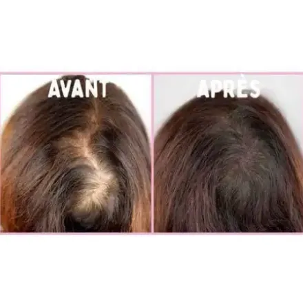 Shampoing Revitalisant Capixyl Blanc Ail thumbnail 3