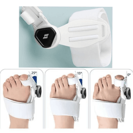 Correcteur D’oignon – Attelle Orthopédique Réglable thumbnail 3
