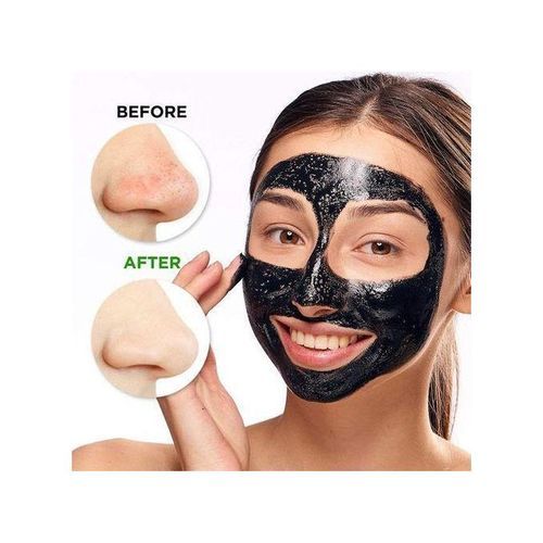 Masque Noir de Carbone pour Éliminer L'acné et les Points Noirs