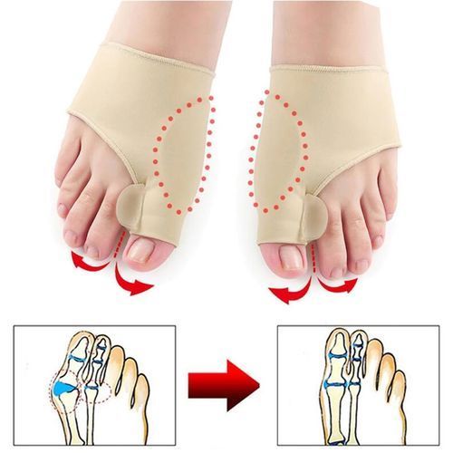 Correcteur D'oignon Et Attelle Orthopédique, Protecteur D'orteils En Gel, 1paire