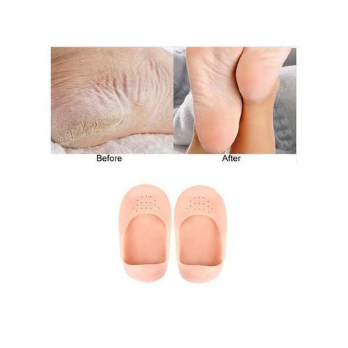 Chaussettes En Silicone Hydratantes - Anti-fissures, Soin Complet Des Pieds