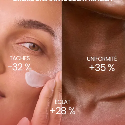 Crème Anti-taches Zones Sensibles – Éclat & Confort