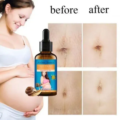 Huile Essentielle - Natural Snail - Élimine Les Vergetures - Réduit La Cellulite