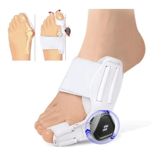 Correcteur d’oignon – Attelle orthopédique réglable