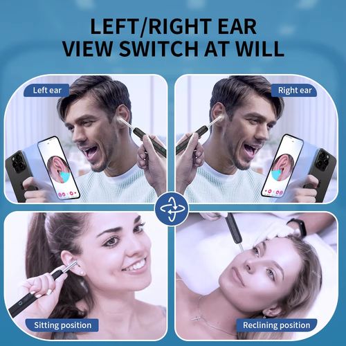 Nettoyeur De Cire D'oreille Sans Fil Avec Caméra,endoscope D'élimination Sûre Du Cérumen Avec Caméra,otoscope Lumineux,outils De Nettoyage Des Oreilles,soins Des Oreilles