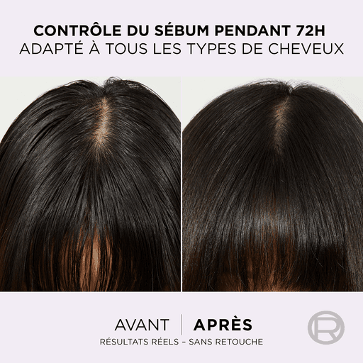 Elseve Après Shampoing Hyaluron Pure thumbnail 4