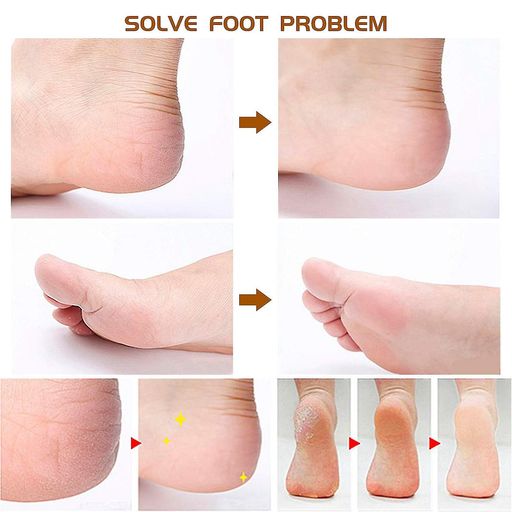 Kit pédicure 7 pièces en acier inoxydable pour soins des pieds féminins (colleur aléatoire) thumbnail 4