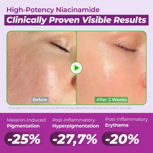 Jumiso Niacinamide 20 Serum - 40ml thumbnail 3
