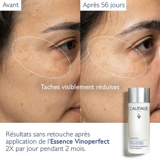 Vinoperfect Essence Glycolique Concentré D'éclat thumbnail 4