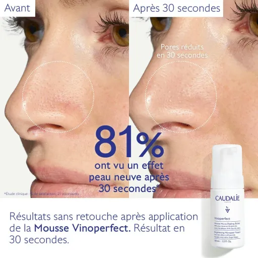 Mousse Micro-peel Éclat Éclaircissant thumbnail 3