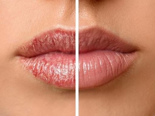 Baume À Lèvres - Mixa - Naturel Rouge Cerise - 4.7g - Nourrissant - Hydratant - 100% Végétal thumbnail 3